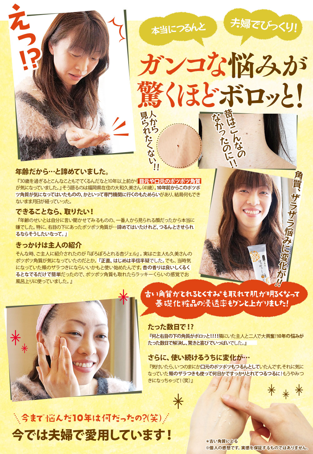 10年の悩みが3日でボロッと！古い角質がとれるとくすみも取れて肌が明るくなって基礎化粧品の浸透率もグンと上がりました！